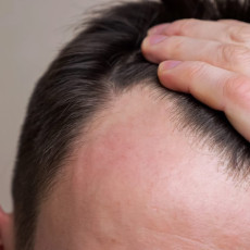 Åysienie â rodzinna przypadÅoÅÄ czy efekt choroby?