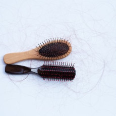 Åysienie telogenowe a androgenowe - jaka jest rÃ³Å¼nica?